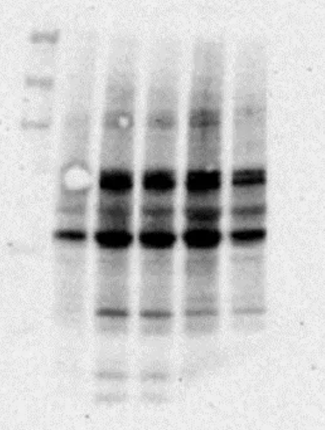 Detected western blot bands